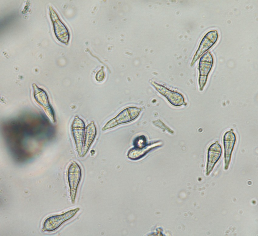 gray leaf spot